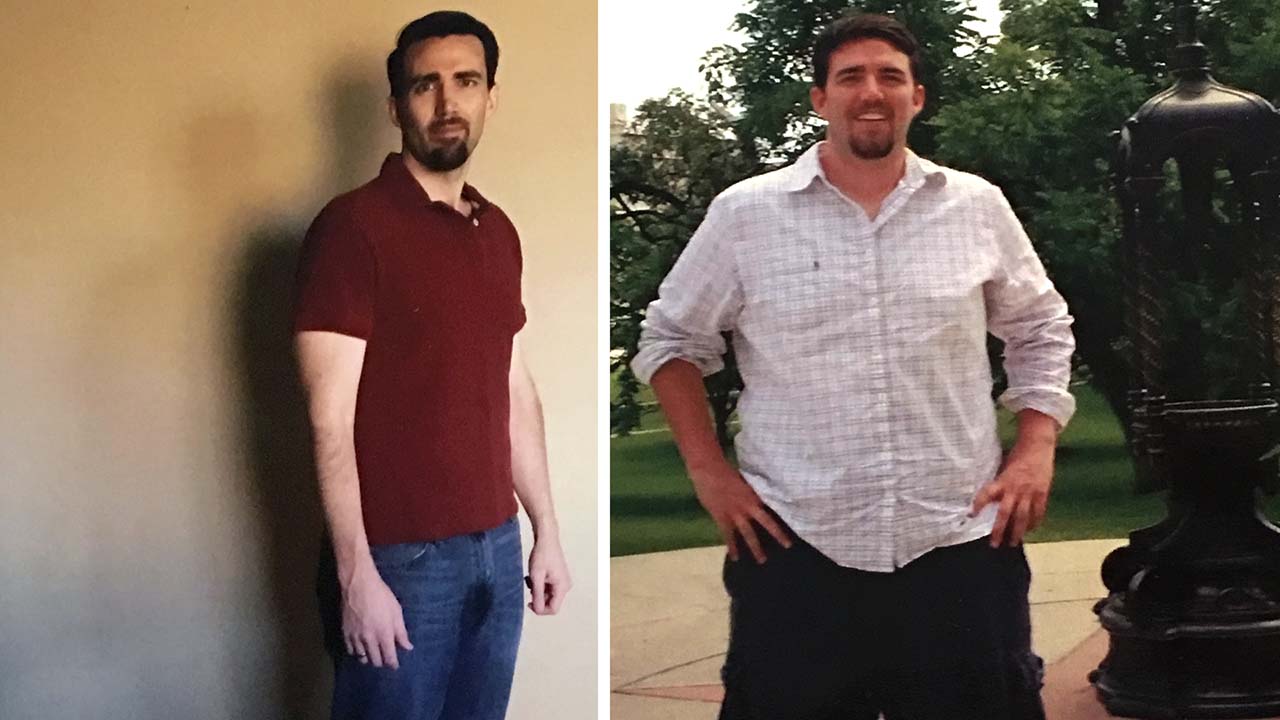 weight loss clinic nyc patient story andrew 01